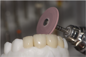 Creaci贸n de dientes