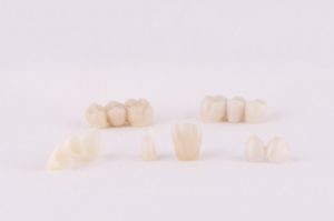 Prótesis dental fija