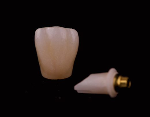 Zirconio sobre implantes